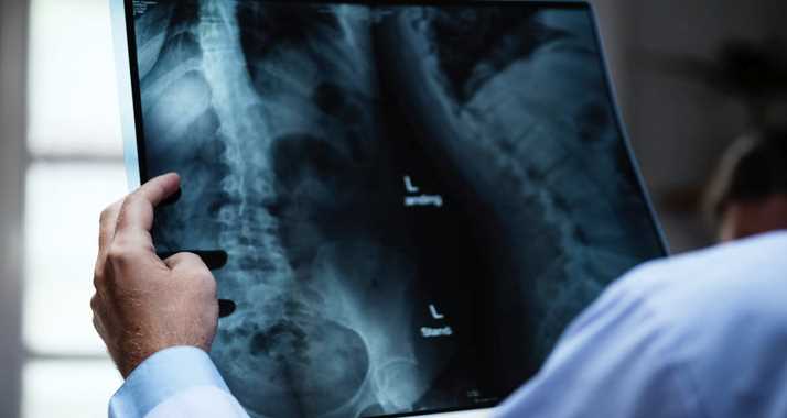 Top 8 Pain-Relieving Benefits (And Risks) Of Spinal Cord Stimulation