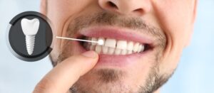Rediscovering Confidence with Dental Implants